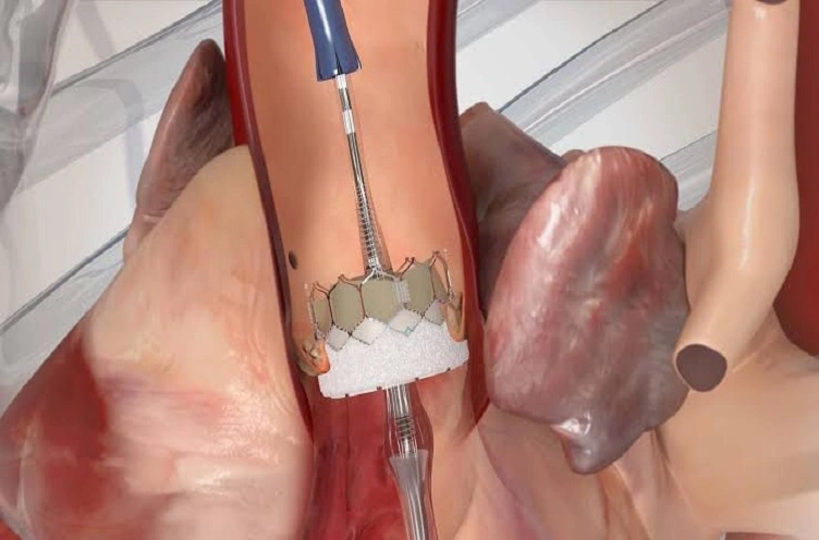 precio-de-intervencion-estructural-en-cdmx